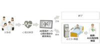 富士通と東大病院、心電図から心臓の動きの異常を推定するAIの臨床研究を開始