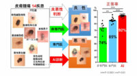 筑波大と京セラグループ、皮膚腫瘍の良悪性を判定するAI診断補助システムを開発