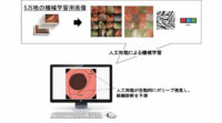 エルピクセルなど、大腸内視鏡病変検出・鑑別診断サポートを行うAIを開発