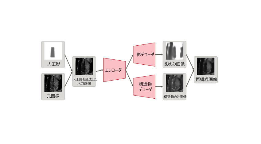 富士通他3者、AIを用いた超音波検査において影を自動検出できる新技術を開発