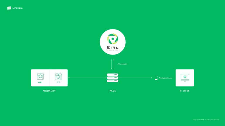 脳MRI画像をAIで解析する医療画像解析ソフトウェア「EIRL aneurysm」　－エルピクセル島原氏インタビュー