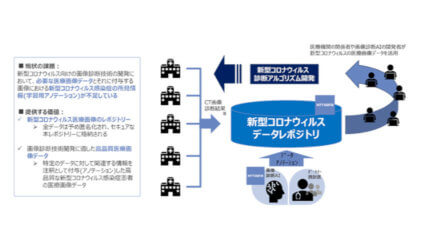 NTT DATA Services、新型コロナウイルス画像診断AI向け学習用データの無償提供開始