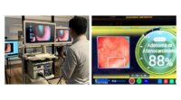 ソフトバンクとAIメディカルサービス、内視鏡検査映像を5Gで伝送してAIによる画像診断補助を行う実証実験を実施