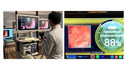 ソフトバンクとAIメディカルサービス、内視鏡検査映像を5Gで伝送してAIによる画像診断補助を行う実証実験を実施