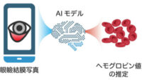 東大とエルピクセル、AI で貧血を予測するヘモグロビン値推定モデルを構築