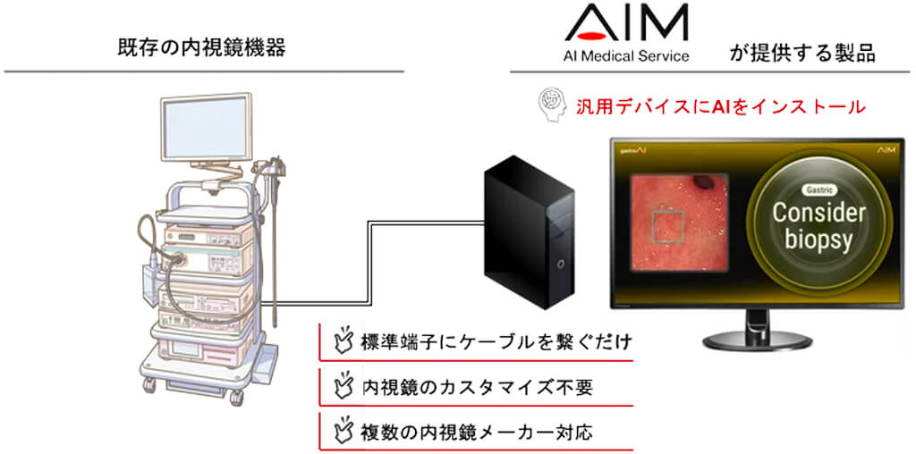 AIメディカルサービス、早期胃がんに特化したAI搭載の内視鏡画像診断支援ソフトウェアを発売