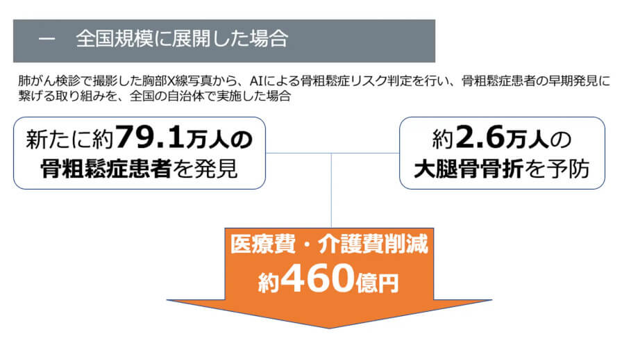 iSurgeryがAIを活用した骨粗鬆症早期発見に関する実証実験の中間解析結果を報告、約2,936万円の医療費削減効果の見込み