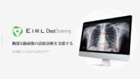 エルピクセル、胸部X線画像の読影診断を支援する「EIRL Chest Screening」の新モデルを発売