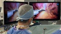 アナウト、AI視覚支援プログラム「Eureka α」を活用した手術に成功
