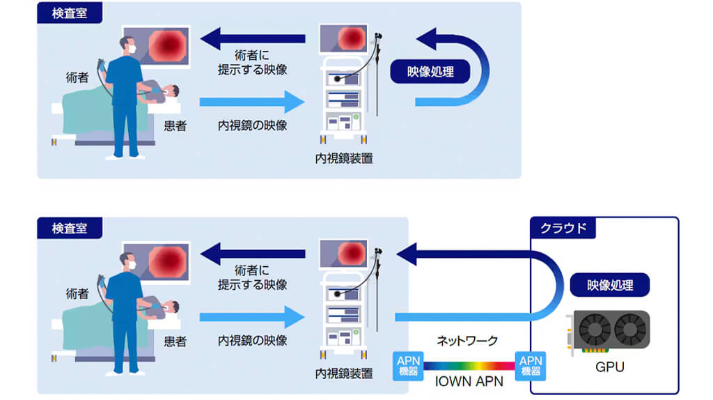 NTTとオリンパス、IOWN APN技術を活用したクラウド内視鏡システムの実証実験を開始