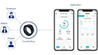Kort Valutaと三井住友海上あいおい生命、ウェアラブルリングを活用したヘルステック実証実験を開始