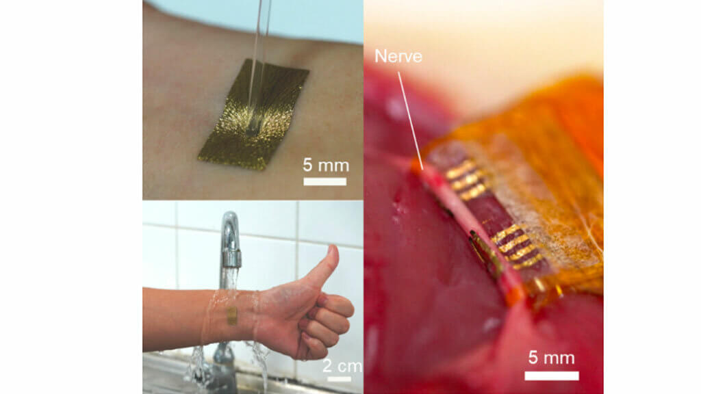 導体は皮膚や臓器に貼り付けることが可能だ